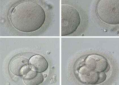 试管婴儿胚胎怎么选择